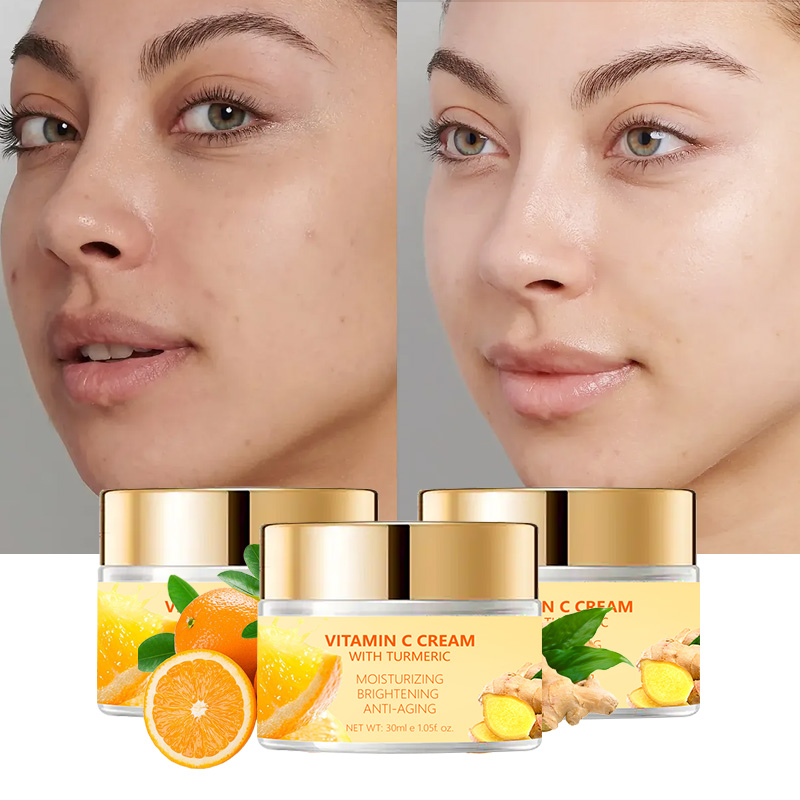 Dê adeus às manchas escuras com creme facial de vitamina C para um brilho jovem